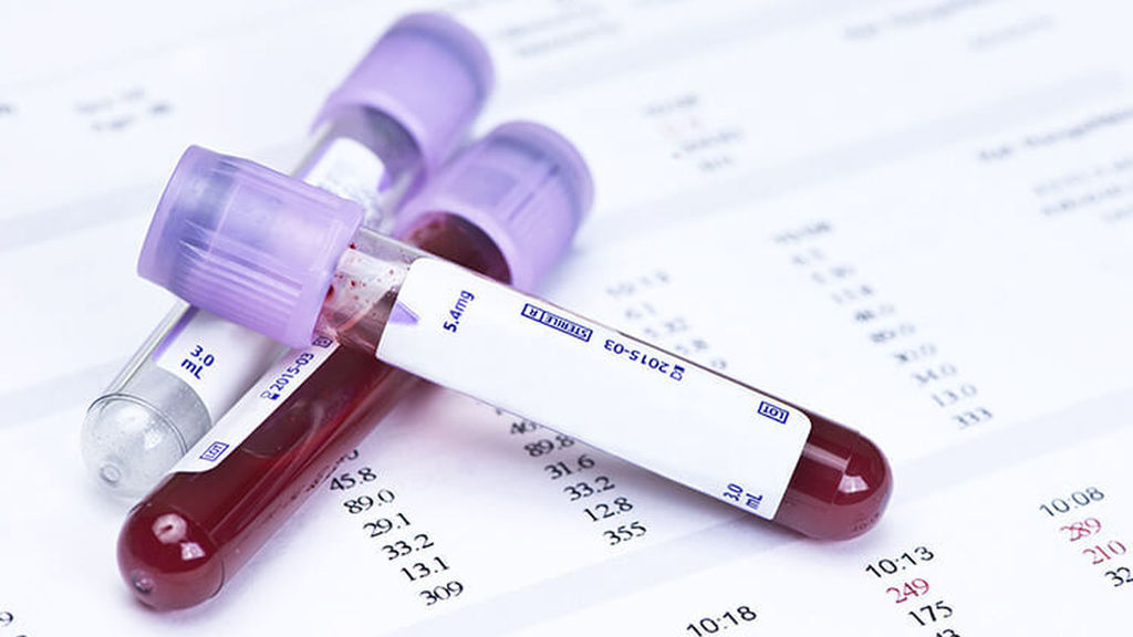 Analisis de sangre Clinica IMIF
