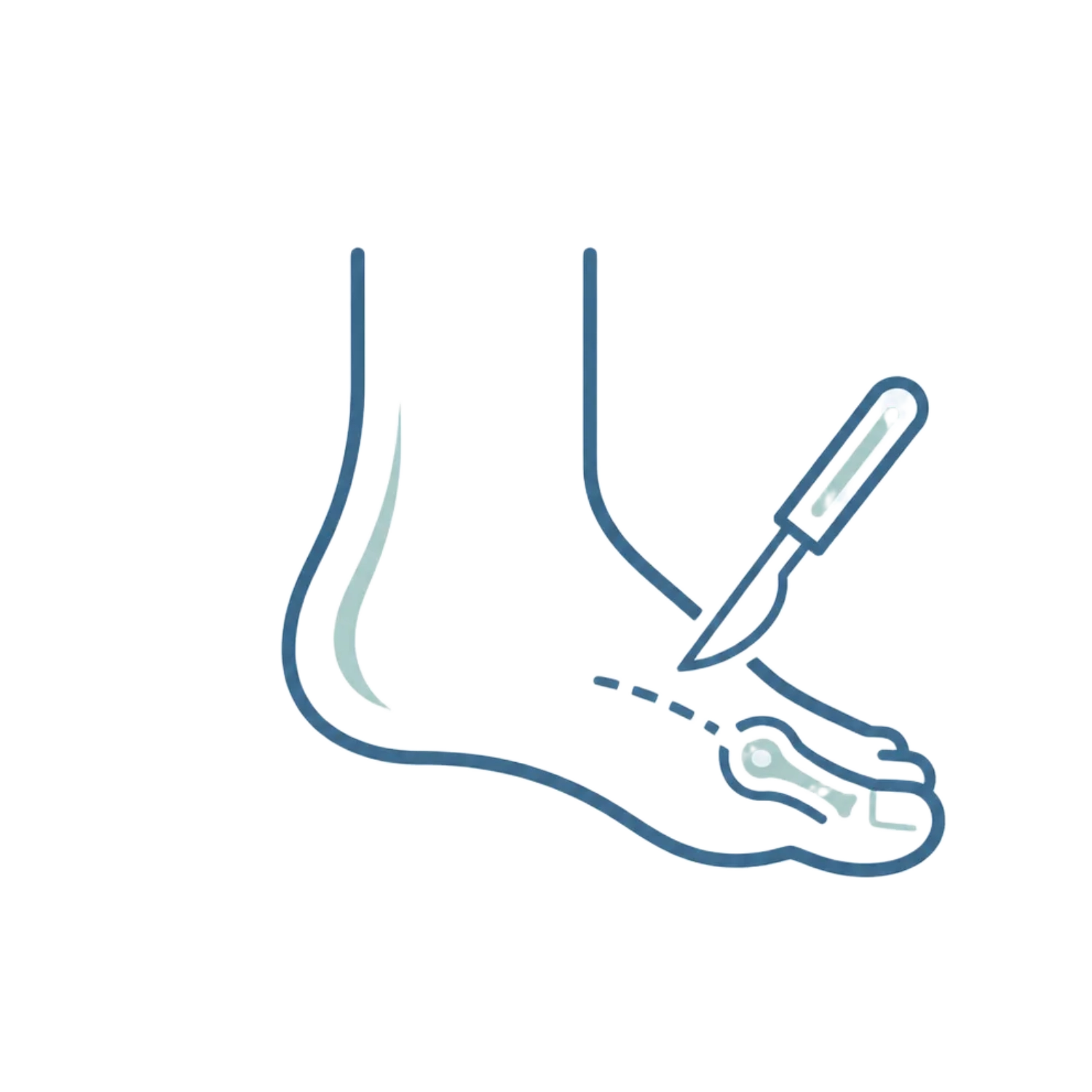 Medical illustration of two blue tubes connected to a handheld surgical tool with a curved blade and dashed motion line.